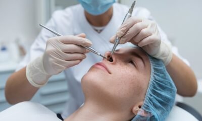 Blackhead removal videos 2025